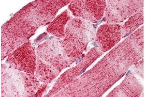 Anti-SLC5A6 antibody  ABIN1049346 IHC staining of human skeletal muscle.