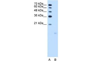 WB Suggested Anti-PPFIBP1 Antibody Titration:  2. (PPFIBP1 anticorps  (N-Term))