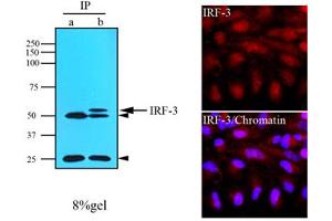 Immunofluorescence of human HeLa cells stained with IRF-3 (1:500) with Texas-Red and Hoechst 33342 (Blue) for nucleus staining.