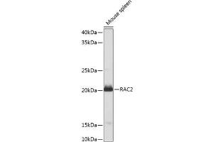 Western blot analysis of extracts of Mouse spleen using RAC2 Polyclonal Antibody at dilution of 1:1000.