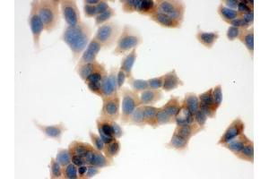 ICC testing of FFPE human MCF7 cells with FASN antibody. (Fatty Acid Synthase anticorps  (AA 1-226))