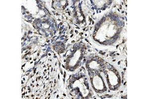 IHC analysis of Occludin/OCLN using anti Occludin/OCLN antibody (ABIN7601995).