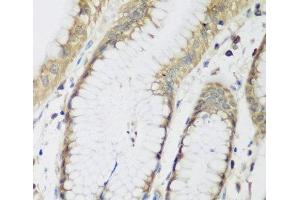 Immunohistochemistry of paraffin-embedded Human stomach using METTL7A Polyclonal Antibody at dilution of 1:200 (40x lens). (METTL7A anticorps)