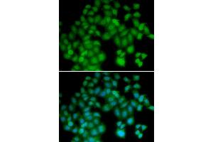 Immunofluorescence (IF) image for anti-Thymosin beta-4 (TMSB4X) antibody (ABIN1876626) (TMSB4X anticorps)