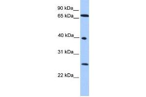 Human HeLa; WB Suggested Anti-L3MBTL2 Antibody Titration: 0. (L3MBTL2 anticorps  (N-Term))