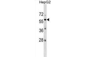 Western Blotting (WB) image for anti-Zinc finger protein 82 homolog (ZFP82) antibody (ABIN2999761) (Zinc finger protein 82 homolog (ZFP82) anticorps)