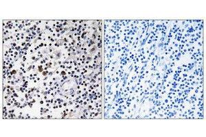 Immunohistochemistry (IHC) image for anti-CD302 (CD302) (Internal Region) antibody (ABIN1850248) (DCL1 anticorps  (Internal Region))