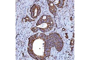 IHC analysis of NDUFS2 using anti-NDUFS2 antibody (ABIN7599417).