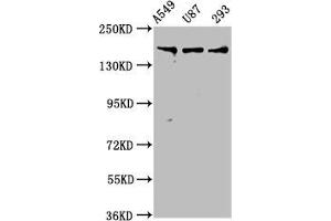 Western Blot Positive WB detected in: A549 whole cell lysate, U87 whole cell lysate, 293 whole cell lysate All lanes: AGRN antibody at 7. (AGRN anticorps  (AA 968-1130))