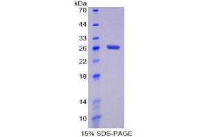 SDS-PAGE (SDS) image for Damage-Specific DNA Binding Protein 2, 48kDa (DDB2) (AA 212-407) protein (His tag) (ABIN1879711)