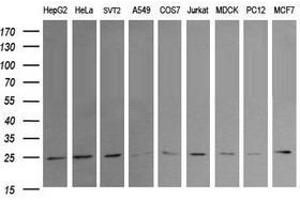 Image no. 2 for anti-RAB21, Member RAS Oncogene Family (RAB21) antibody (ABIN1500548) (RAB21 anticorps)