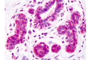 Anti-Aldolase antibody IHC of human breast.