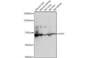 Western blot analysis of extracts of various cell lines, using CES1 Rabbit mAb (ABIN7266077) at 1:1000 dilution. (CES1 anticorps)