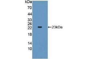 Detection of Recombinant AK2, Rat using Polyclonal Antibody to Adenylate Kinase 2 (AK2) (Adenylate Kinase 2 anticorps  (AA 64-232))