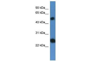 Western Blot showing SLA2 antibody used at a concentration of 1-2 ug/ml to detect its target protein.