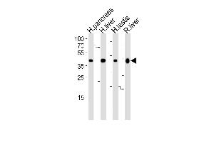 Western blot analysis of lysates from human pancreas, liver, testis and rat liver tissue lysate (from left to right), using HMGCS2 Antibody (C-term) (ABIN390764 and ABIN2841022). (HMGCS2 anticorps  (C-Term))