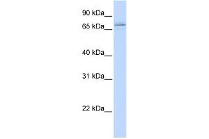 WB Suggested Anti-MAK Antibody Titration:  0. (MAK anticorps  (C-Term))