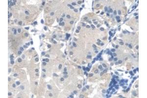 Detection of FUM in Human Stomach Tissue using Polyclonal Antibody to Fumarase (FUM)