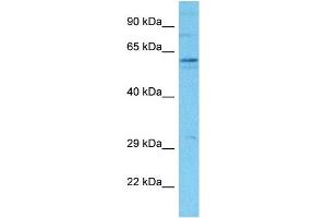 Host:  Rabbit  Target Name:  SLCO2B1  Sample Tissue:  Human Hela Whole Cell  Antibody Dilution:  1ug/ml (SLCO2B1 anticorps  (N-Term))