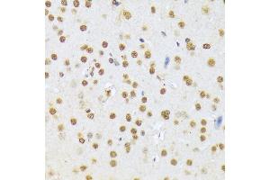 Immunohistochemistry of paraffin-embedded mouse brain using CF antibody (3087) at dilution of 1:100 (40x lens).