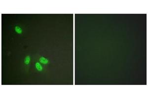 Immunofluorescence analysis of HeLa cells, using hnRPD (epitope around residue 83) antibody. (HNRNPD/AUF1 anticorps  (Ser83))