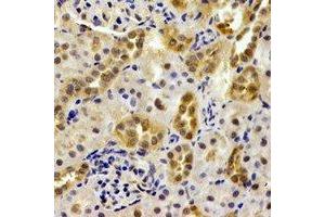 Immunohistochemical analysis of PSMB9 staining in mouse kidney formalin fixed paraffin embedded tissue section. (PSMB9 anticorps)