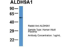 Host: Rabbit  Target Name: ALDH9A1  Sample Tissue: Human Adult Placenta  Antibody Dilution: 1. (ALDH9A1 anticorps  (C-Term))