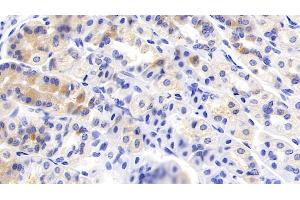 Detection of HGF in Mouse Stomach Tissue using Polyclonal Antibody to Hepatocyte Growth Factor (HGF)