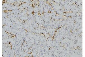 ABIN6279737 at 1/100 staining Mouse kidney tissue by IHC-P.