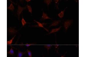 Immunofluorescence analysis of C6 cells using GPER1 Polyclonal Antibody at dilution of 1:100.