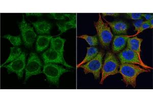 ICC/IF Image TRIM23 antibody [N1], N-term detects TRIM23 protein at cytoplasm by immunofluorescent analysis.