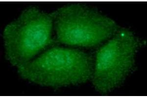 ICC/IF analysis of ING2 in Hep3B cells line, stained with DAPI (Blue) for nucleus staining and monoclonal anti-human ING2 antibody (1:100) with goat anti-mouse IgG-Alexa fluor 488 conjugate (Green).