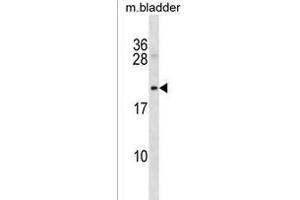 Rat Mycb Antibody (C-term) (ABIN1536682 and ABIN2850194) western blot analysis in mouse bladder tissue lysates (35 μg/lane). (Protein B-Myc anticorps  (C-Term))