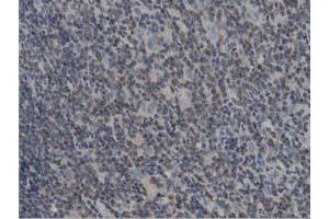 Immunohistochemical staining of paraffin-embedded Human lymph node tissue using anti-DNAJA2 mouse monoclonal antibody. (DNAJA2 anticorps)