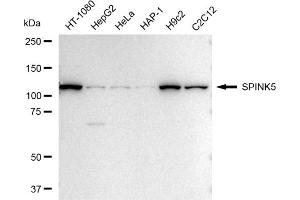 Western blotting analysis using SPINK5 antibody (ABIN7800302).