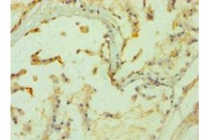Immunohistochemistry of paraffin-embedded human prostate tissue using ABIN7169286 at dilution of 1:100 (PPP3CC anticorps  (Catalytic Subunit gamma))