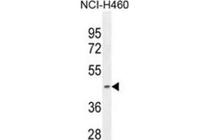 Western Blotting (WB) image for anti-Pyruvate Dehydrogenase (Lipoamide) alpha 2 (PDHa2) antibody (ABIN2995821) (PDHA2 anticorps)