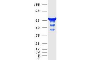 Validation with Western Blot