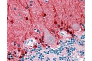 anti-Amphiphysin (AMPH) (Internal Region) antibody