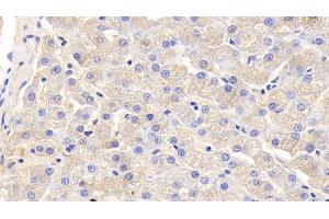 Detection of IL5 in Canine Liver Tissue using Polyclonal Antibody to Interleukin 5 (IL5) (IL-5 anticorps  (AA 20-134))