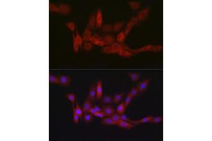 Immunofluorescence analysis of PC-12 cells using PGD Rabbit mAb (ABIN7269315) at dilution of 1:100 (40x lens).