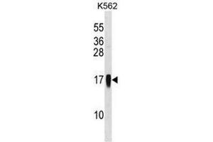 CCL7 Antibody (Center) western blot analysis in K562 cell line lysates (35µg/lane). (CCL7 anticorps  (Middle Region))