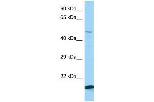 Host: Rabbit Target Name: Kbtbd2 Sample Type: Mouse Testis lysates Antibody Dilution: 1. (KBTBD2 anticorps  (N-Term))