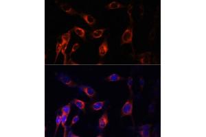 Immunofluorescence analysis of NIH-3T3 cells using TSC1 Polyclonal Antibody (ABIN6133755, ABIN6149609, ABIN6149610 and ABIN6213968) at dilution of 1:100 (40x lens).