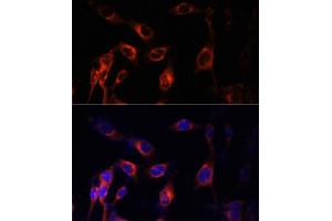 Immunofluorescence analysis of NIH-3T3 cells using TSC1 Polyclonal Antibody (ABIN6133755, ABIN6149609, ABIN6149610 and ABIN6213968) at dilution of 1:100 (40x lens). (TSC1 anticorps  (AA 550-650))
