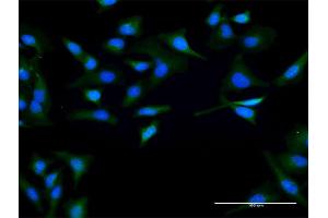 Immunofluorescence of purified MaxPab antibody to SPO11 on HeLa cell. (SPO11 anticorps  (AA 1-358))