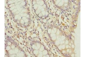 anti-DEAD (Asp-Glu-Ala-Asp) Box Polypeptide 20 (DDX20) (AA 25-280) antibody