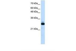 Image no. 1 for anti-Sin3A-Associated Protein, 30kDa (SAP30) (AA 151-200) antibody (ABIN324469) (SAP30 anticorps  (AA 151-200))
