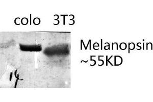 Western blot analysis of various lysates using Melanopsin Polyclonal Antibody. (OPN4 anticorps  (AA 400-480))
