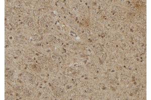 ABIN6279715 at 1/100 staining Rat brain tissue by IHC-P.